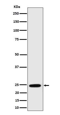 Anti-RalA Rabbit Monoclonal Antibody Boster Bio