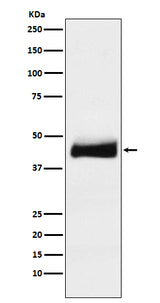 Anti-ORM1 Monoclonal Antibody Boster Bio