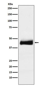 Anti-ORM1 Monoclonal Antibody Boster Bio