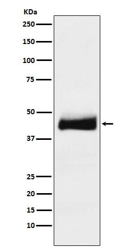 Anti-ORM1 Monoclonal Antibody Boster Bio