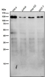 Anti-Meckelin Rabbit Monoclonal Antibody Boster Bio