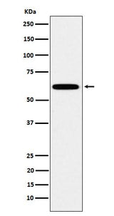 Anti-HSF2 Rabbit Monoclonal Antibody Boster Bio