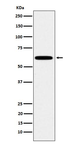 Anti-HSF2 Rabbit Monoclonal Antibody Boster Bio