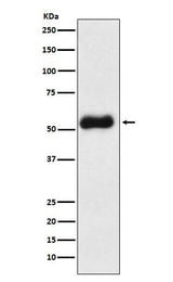 Anti-Thromboxane synthase Rabbit Monoclonal Antibody Boster Bio