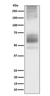 Anti-Somatostatin Receptor 1 Rabbit Monoclonal Antibody Boster Bio