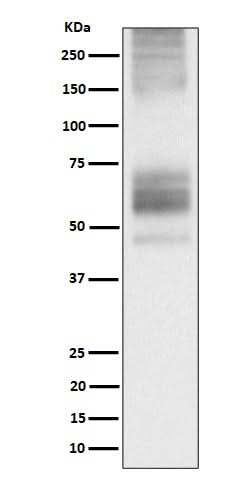 Anti-Somatostatin Receptor 1 Rabbit Monoclonal Antibody Boster Bio