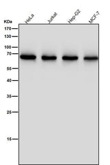 Anti-ENT2 Rabbit Monoclonal Antibody Boster Bio
