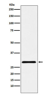 Anti-cbx7 Monoclonal Antibody Boster Bio