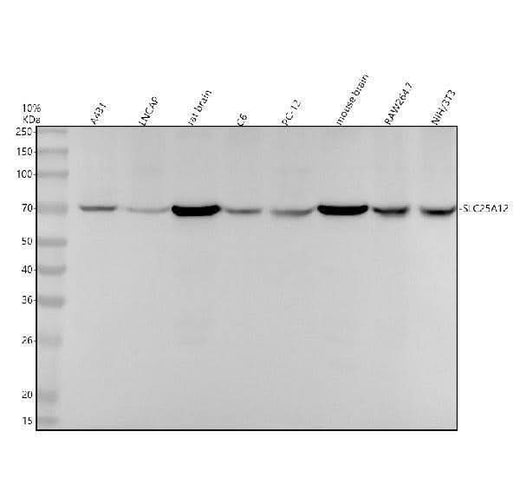 Anti-SLC25A12 Rabbit Monoclonal Antibody Boster Bio