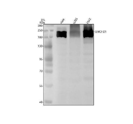 Anti-SMCHD1 Rabbit Monoclonal Antibody Boster Bio