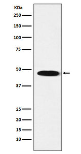 Anti-GABA A Receptor beta 1 Rabbit Monoclonal Antibody Boster Bio