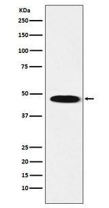 Anti-GABA A Receptor beta 1 Rabbit Monoclonal Antibody Boster Bio