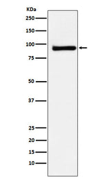 Anti-KAISO Rabbit Monoclonal Antibody Boster Bio