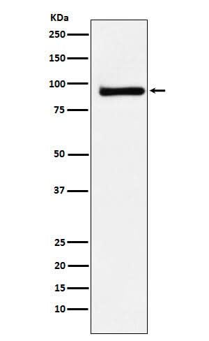 Anti-KAISO Rabbit Monoclonal Antibody Boster Bio