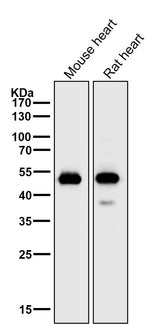 Anti-alpha Sarcoglycan Rabbit Monoclonal Antibody Boster Bio