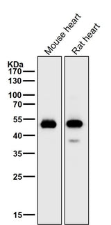 Anti-alpha Sarcoglycan Rabbit Monoclonal Antibody Boster Bio
