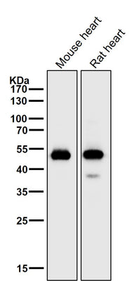 Anti-alpha Sarcoglycan Rabbit Monoclonal Antibody Boster Bio
