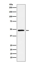Anti-NR2E1 Rabbit Monoclonal Antibody Boster Bio