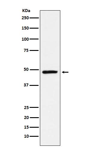 Anti-NR2E1 Rabbit Monoclonal Antibody Boster Bio