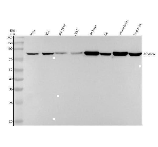 Anti-ACVR2A Rabbit Monoclonal Antibody Boster Bio