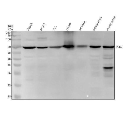 Anti-PCK2 Monoclonal Antibody Boster Bio