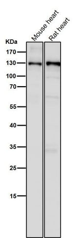 Anti-CC2D1A Rabbit Monoclonal Antibody Boster Bio