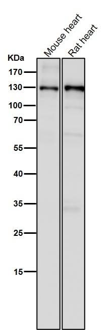 Anti-CC2D1A Rabbit Monoclonal Antibody Boster Bio