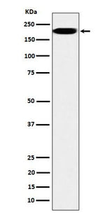 Anti-IQGAP2 Rabbit Monoclonal Antibody Boster Bio