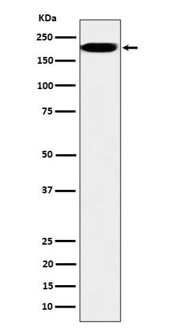 Anti-IQGAP2 Rabbit Monoclonal Antibody Boster Bio