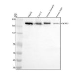 Anti-IQGAP2 Rabbit Monoclonal Antibody Boster Bio