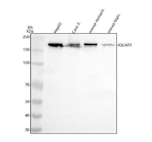 Anti-IQGAP2 Rabbit Monoclonal Antibody Boster Bio