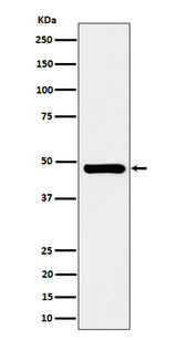 Anti-SNX5 Rabbit Monoclonal Antibody Boster Bio
