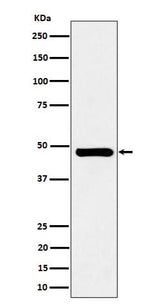 Anti-SNX5 Rabbit Monoclonal Antibody Boster Bio