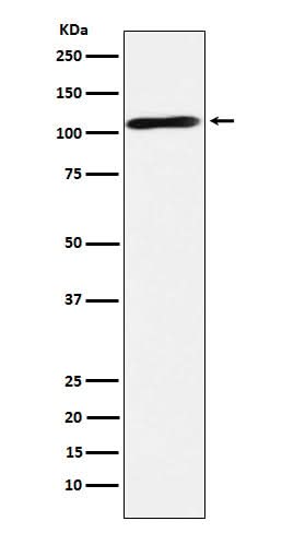 Anti-Epac2 Rabbit Monoclonal Antibody Boster Bio