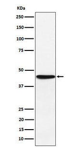 Anti-HLA F Rabbit Monoclonal Antibody Boster Bio