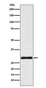 Anti-VPS24 Rabbit Monoclonal Antibody Boster Bio