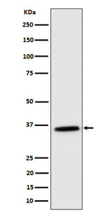 Anti-MDH2 Rabbit Monoclonal Antibody Boster Bio
