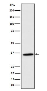 Anti-MDH2 Rabbit Monoclonal Antibody Boster Bio