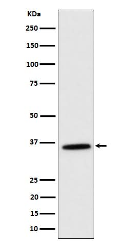 Anti-MDH2 Rabbit Monoclonal Antibody Boster Bio