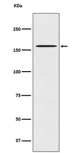Anti-CLASP1 Rabbit Monoclonal Antibody Boster Bio