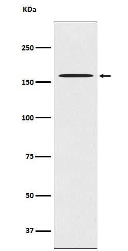 Anti-CLASP1 Rabbit Monoclonal Antibody Boster Bio
