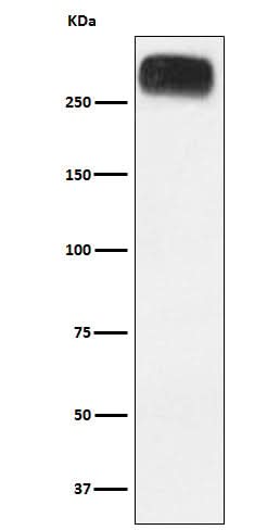 Anti-mGluR3 Rabbit Monoclonal Antibody Boster Bio