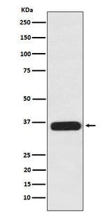 Anti-PDLIM1 Rabbit Monoclonal Antibody Boster Bio