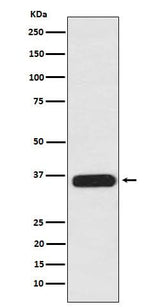 Anti-PDLIM1 Rabbit Monoclonal Antibody Boster Bio