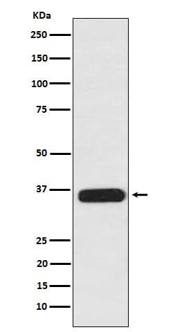 Anti-PDLIM1 Rabbit Monoclonal Antibody Boster Bio