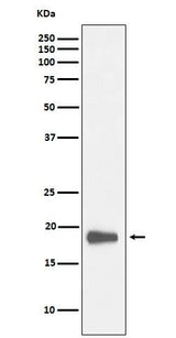 Anti-HMGN2 Rabbit Monoclonal Antibody Boster Bio