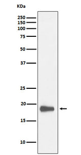 Anti-HMGN2 Rabbit Monoclonal Antibody Boster Bio