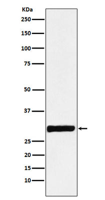 Anti-Annexin IV Rabbit Monoclonal Antibody Boster Bio