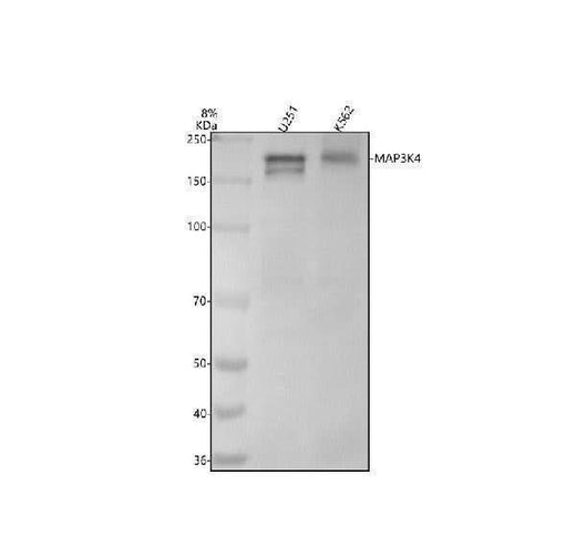 Anti-MAP3K4 Rabbit Monoclonal Antibody Boster Bio