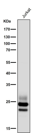 Anti-CD3G Rabbit Monoclonal Antibody Boster Bio
